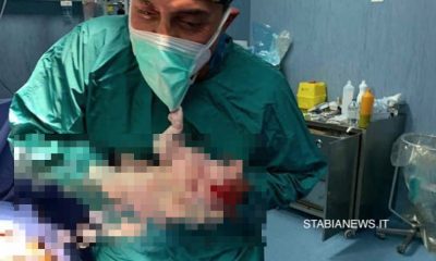 Castellammare. Alla nascita prova a strappare la mascherina al medico: l'episodio alla clinica Villa Stabia 39 Federlab